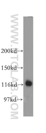 NAT10 Antibody in Western Blot (WB)