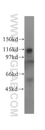 NAT10 Antibody in Western Blot (WB)