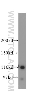 NAT10 Antibody in Western Blot (WB)