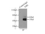 TDG Antibody in Immunoprecipitation (IP)