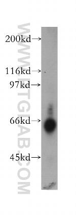 TDG Antibody in Western Blot (WB)