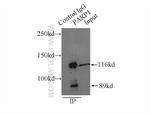 PARP1 Antibody in Immunoprecipitation (IP)