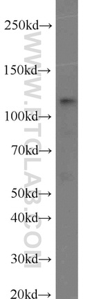 PARP1 Antibody in Western Blot (WB)