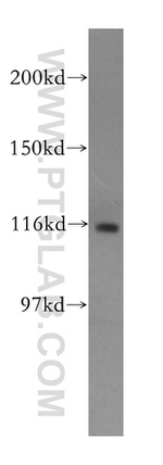 PARP1 Antibody in Western Blot (WB)