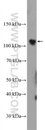 PARP1 Antibody in Western Blot (WB)