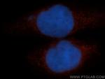 TFEB Antibody in Immunocytochemistry (ICC/IF)