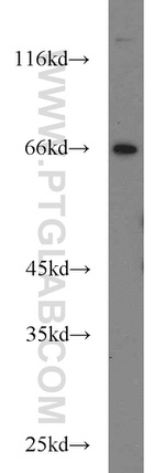 TFEB Antibody in Western Blot (WB)