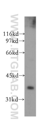 PTGR1 Antibody in Western Blot (WB)