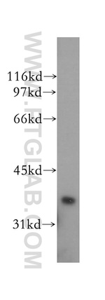 PTGR1 Antibody in Western Blot (WB)