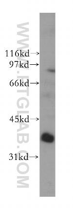 PTGR1 Antibody in Western Blot (WB)