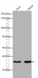 PTGR1 Antibody in Western Blot (WB)