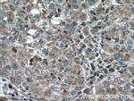 CDC20B Antibody in Immunohistochemistry (Paraffin) (IHC (P))