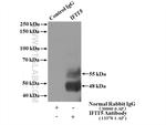 IFIT5 Antibody in Immunoprecipitation (IP)