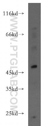 IFIT5 Antibody in Western Blot (WB)