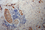 Amphiphysin Antibody in Immunohistochemistry (Paraffin) (IHC (P))