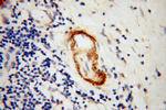 Amphiphysin Antibody in Immunohistochemistry (Paraffin) (IHC (P))