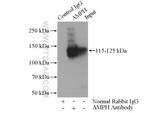 Amphiphysin Antibody in Immunoprecipitation (IP)