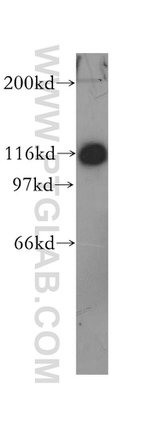Amphiphysin Antibody in Western Blot (WB)