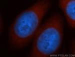 NCAPD2 Antibody in Immunocytochemistry (ICC/IF)