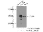 NCAPD2 Antibody in Immunoprecipitation (IP)