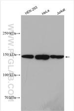 NCAPD2 Antibody in Western Blot (WB)