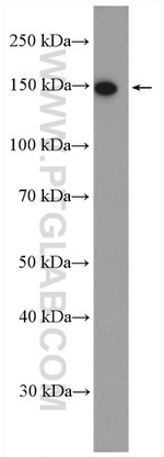 NCAPD2 Antibody in Western Blot (WB)