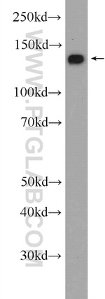 NCAPD2 Antibody in Western Blot (WB)