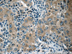 HSPH1 Antibody in Immunohistochemistry (Paraffin) (IHC (P))