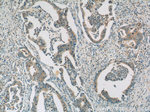 HSPH1 Antibody in Immunohistochemistry (Paraffin) (IHC (P))