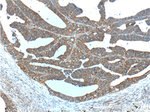 HSPH1 Antibody in Immunohistochemistry (Paraffin) (IHC (P))