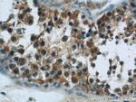 HSPH1 Antibody in Immunohistochemistry (Paraffin) (IHC (P))