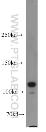 HSPH1 Antibody in Western Blot (WB)