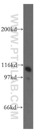 HSPH1 Antibody in Western Blot (WB)