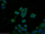 CPN1 Antibody in Immunocytochemistry (ICC/IF)