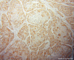 CPN1 Antibody in Immunohistochemistry (Paraffin) (IHC (P))