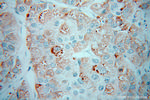 CPN1 Antibody in Immunohistochemistry (Paraffin) (IHC (P))