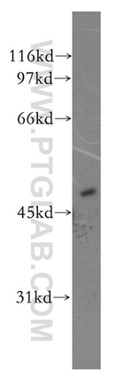 CPN1 Antibody in Western Blot (WB)