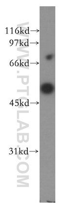 CPN1 Antibody in Western Blot (WB)