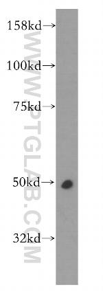 CPN1 Antibody in Western Blot (WB)