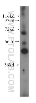 IHH Antibody in Western Blot (WB)