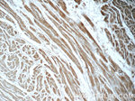 PFKP Antibody in Immunohistochemistry (Paraffin) (IHC (P))