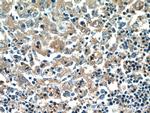 PFKP Antibody in Immunohistochemistry (Paraffin) (IHC (P))