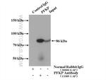 PFKP Antibody in Immunoprecipitation (IP)