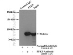 PFKP Antibody in Immunoprecipitation (IP)