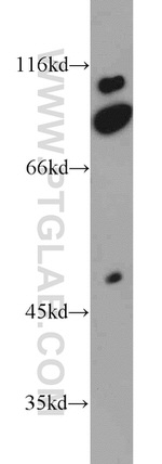 PFKP Antibody in Western Blot (WB)