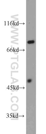 PFKP Antibody in Western Blot (WB)