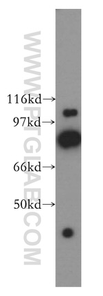 PFKP Antibody in Western Blot (WB)