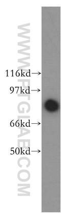 PFKP Antibody in Western Blot (WB)