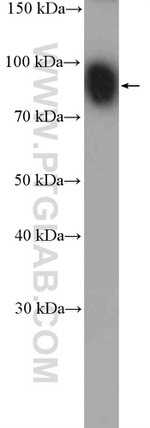 PFKP Antibody in Western Blot (WB)