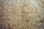 Galectin-4 Antibody in Immunohistochemistry (Paraffin) (IHC (P))